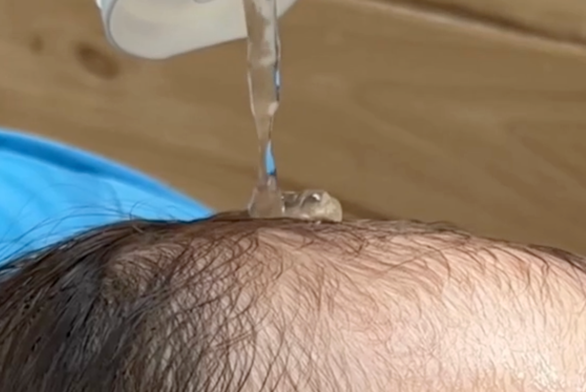 Shampoo on baby scalp