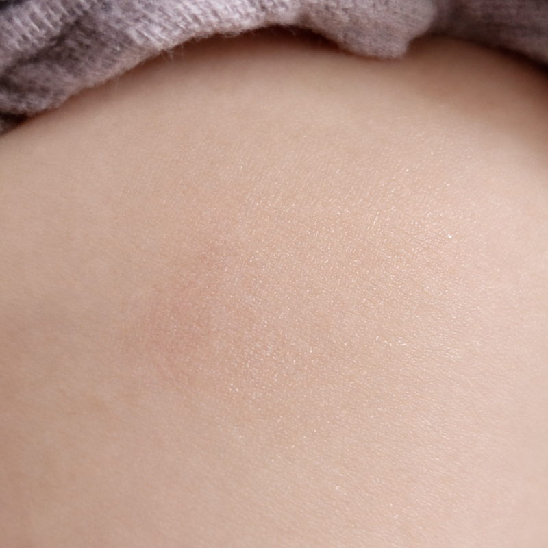 dry patches