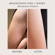 Saya Brightening Peel