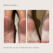 Saya Brightening Peel