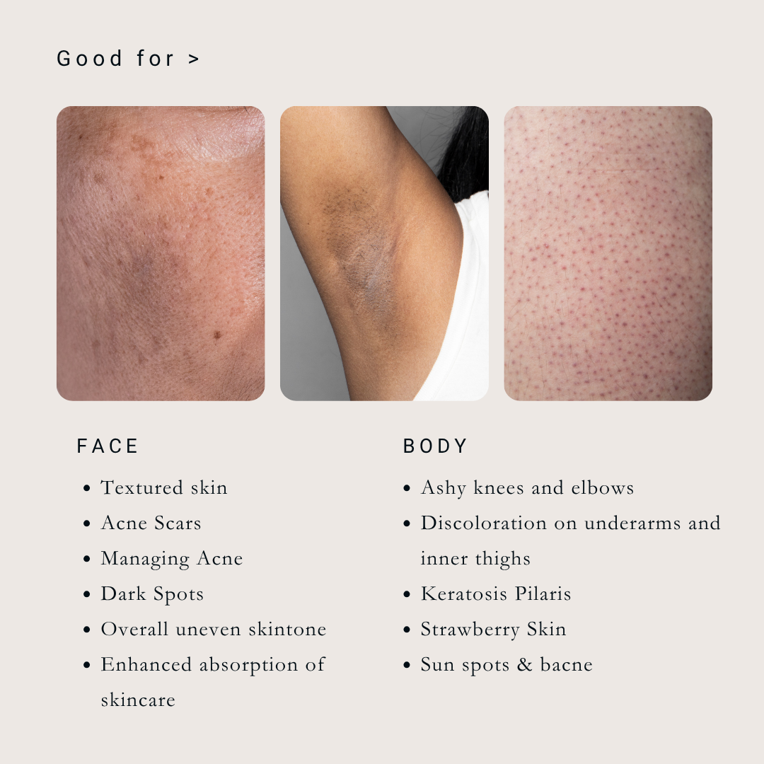 Saya Brightening Peel