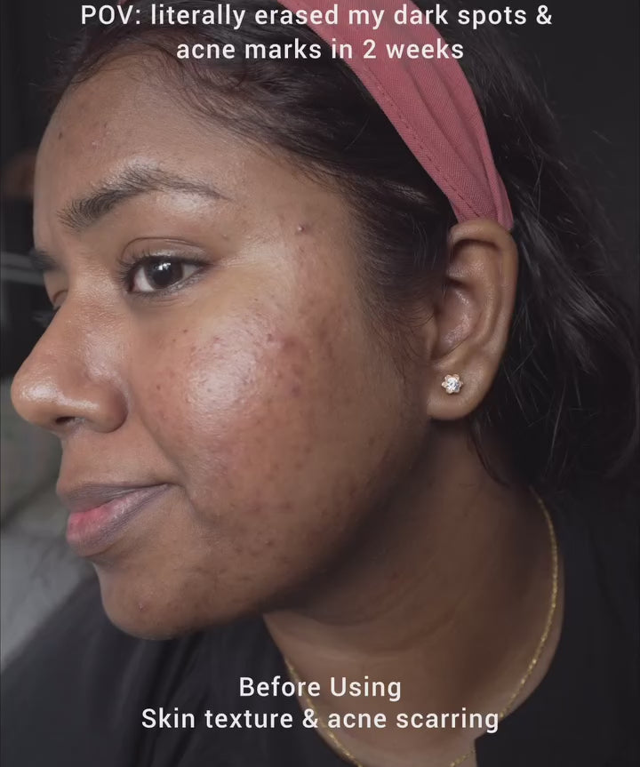 a girl using saya brightening peel on her face