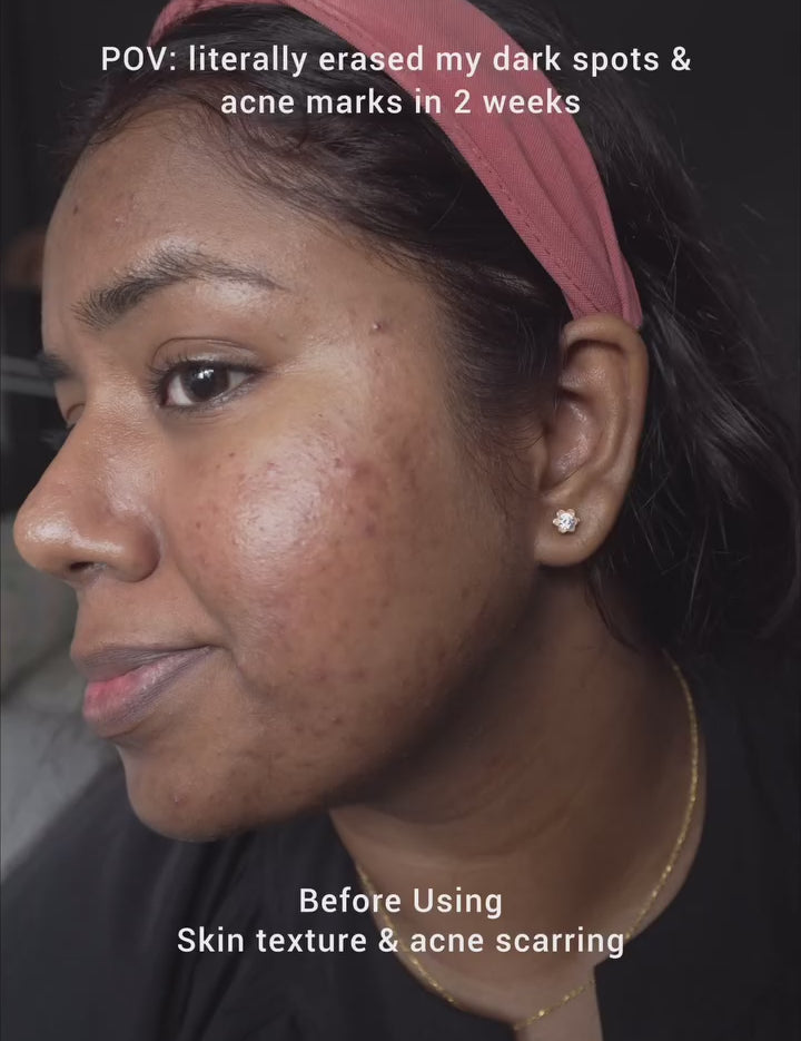 a girl using saya brightening peel on her face