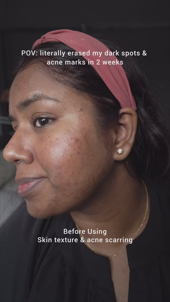 a girl using saya brightening peel on her face