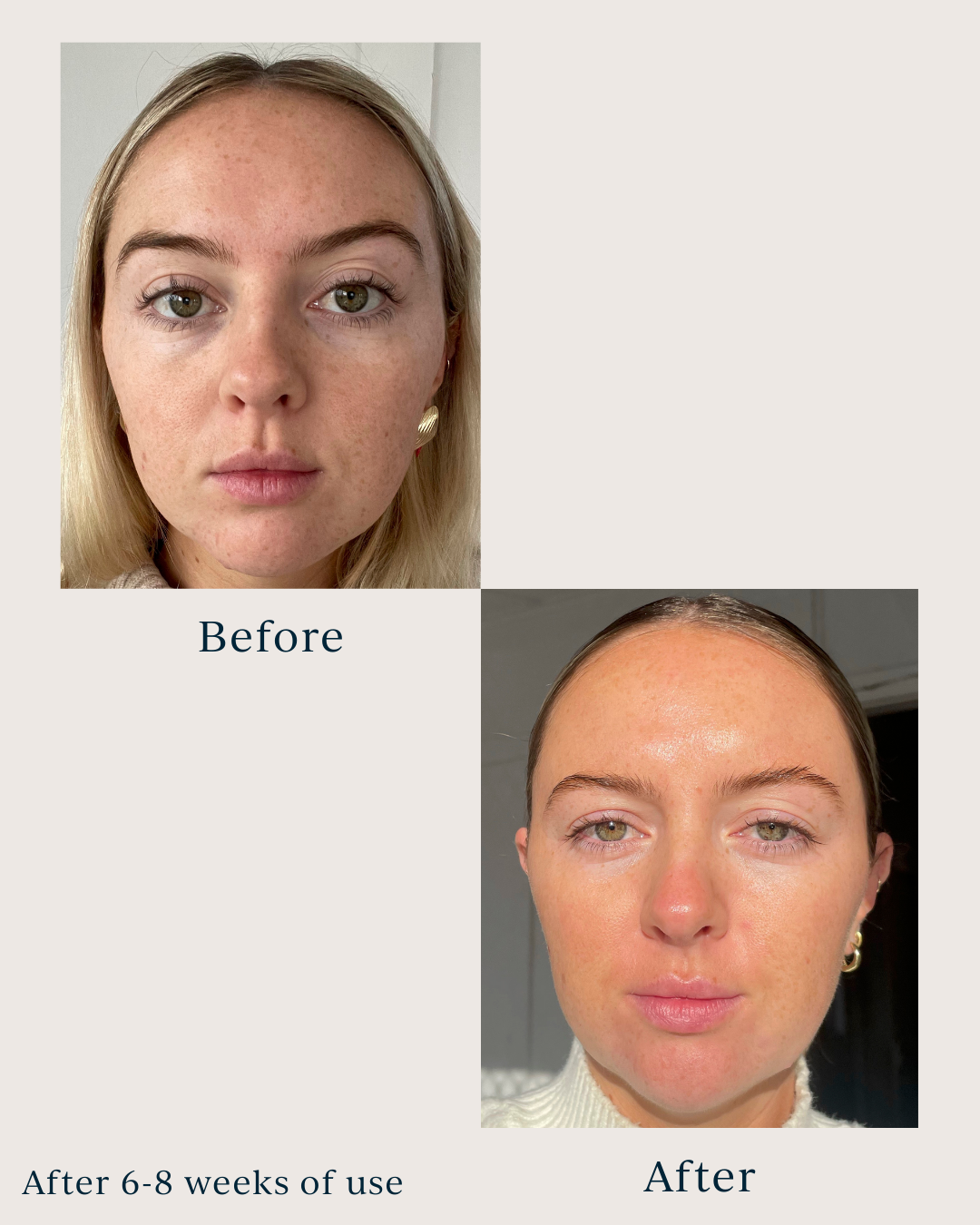 skin texture before and after using saya brightening peel