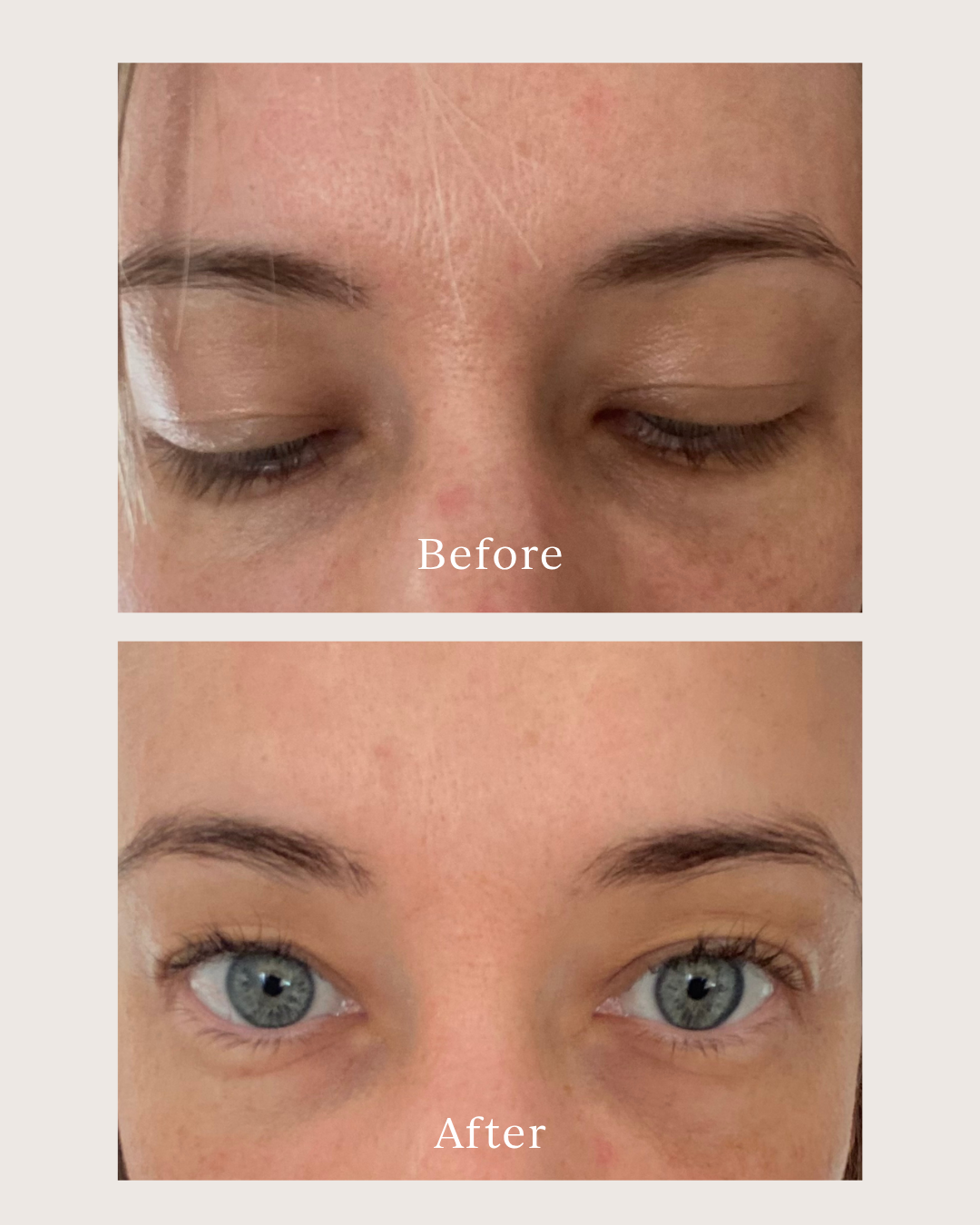 before and after photo of a woman using renew serum