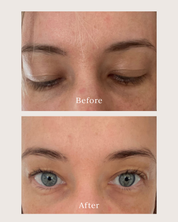 before and after photo of a woman using renew serum