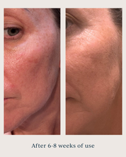 skin texture before and after using renew serum