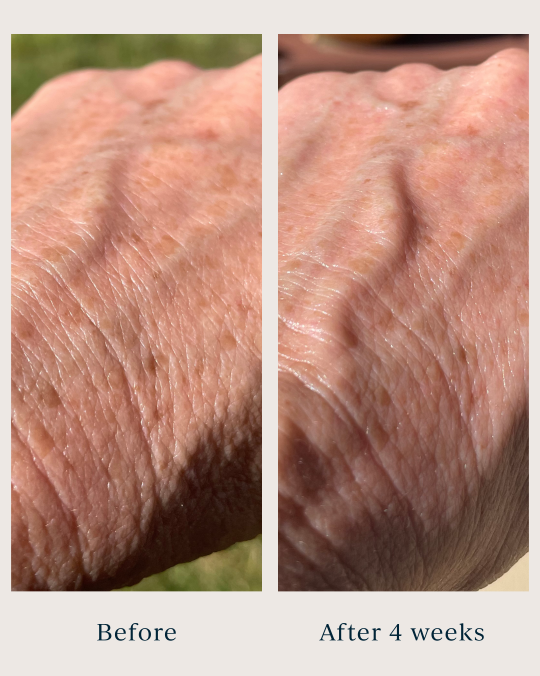 dark spots and micro wrinkles after using saya argan body oil