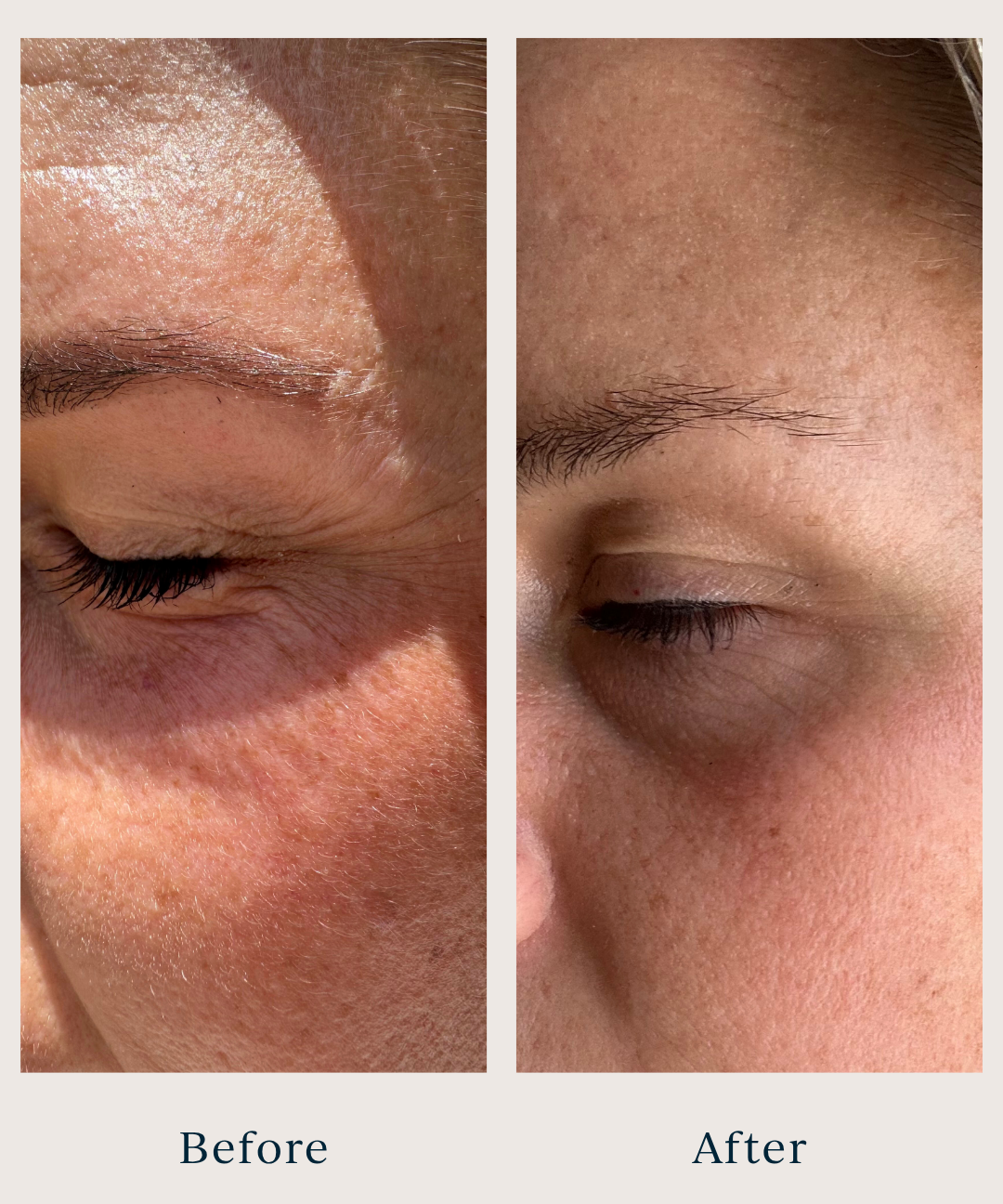 before and after pictures of a woman after using saya eye cream
