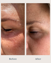 before and after pictures of a woman after using saya eye cream