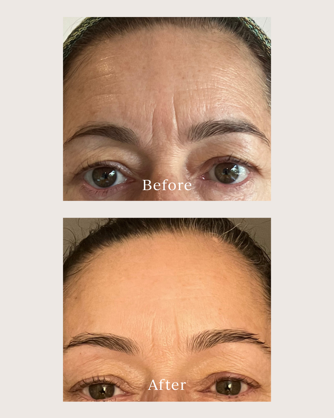 before and after pictures of a woman using renew serum