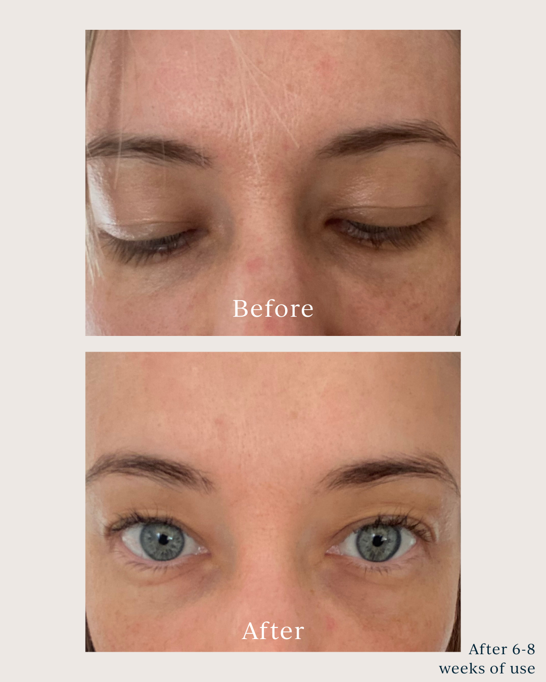 skin texture before and after using saya renew serum