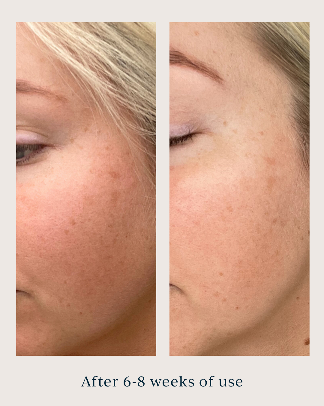 skin tone and texture after using saya super serum