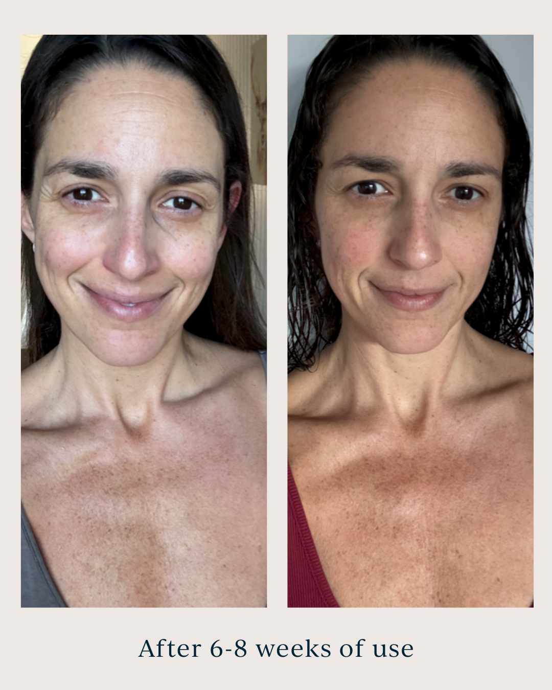 skin texture before and after using saya super serum