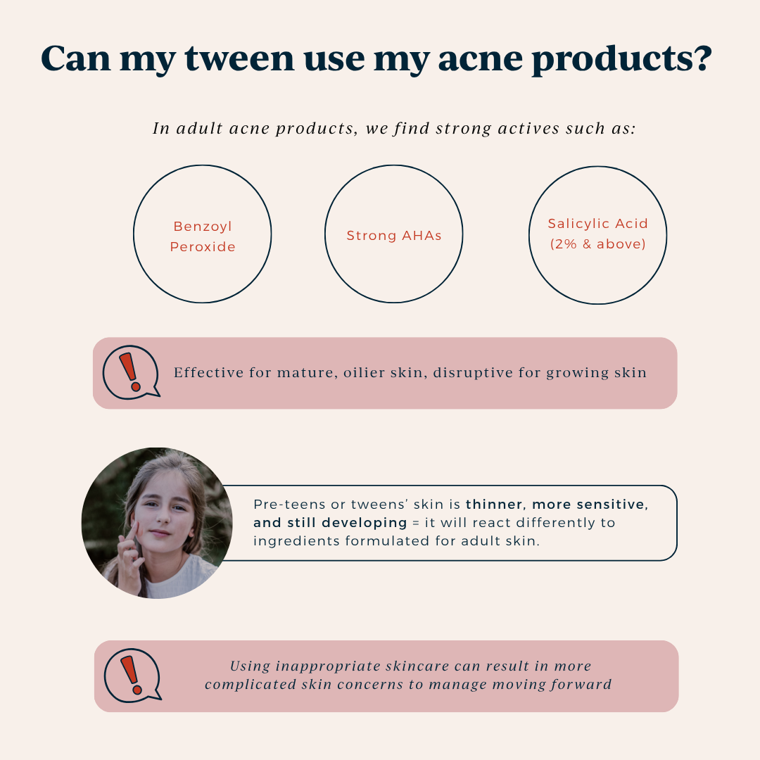 common ingredients in adult acne products unsuitable for tweens