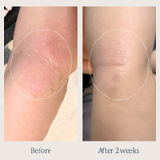 TOOFRUIT Magi'soin | My Multi-Purpose Balm