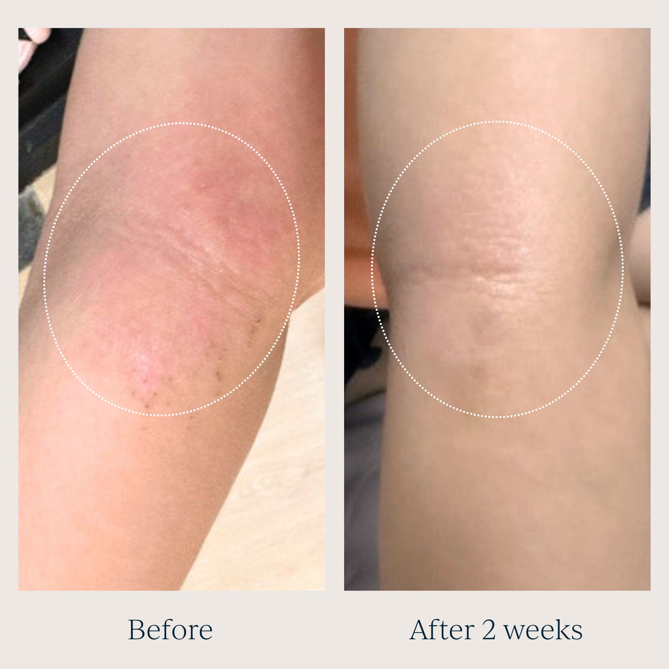 TOOFRUIT Magi'soin | My Multi-Purpose Balm