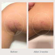 TOOFRUIT Magi'soin | My Multi-Purpose Balm