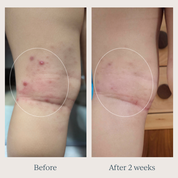 TOOFRUIT Magi'soin | My Multi-Purpose Balm