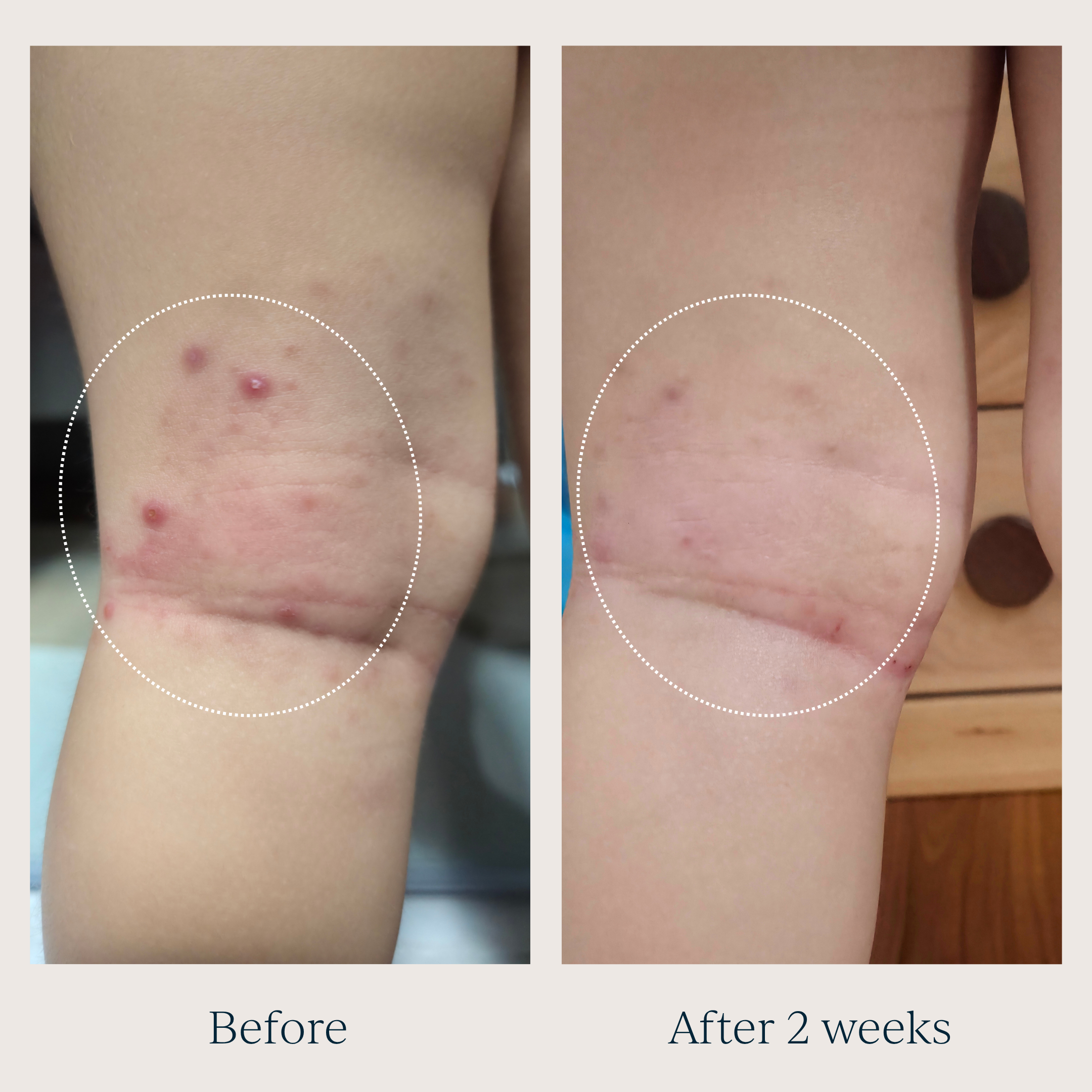 TOOFRUIT Magi'soin | My Multi-Purpose Balm