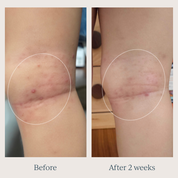 TOOFRUIT Magi'soin | My Multi-Purpose Balm