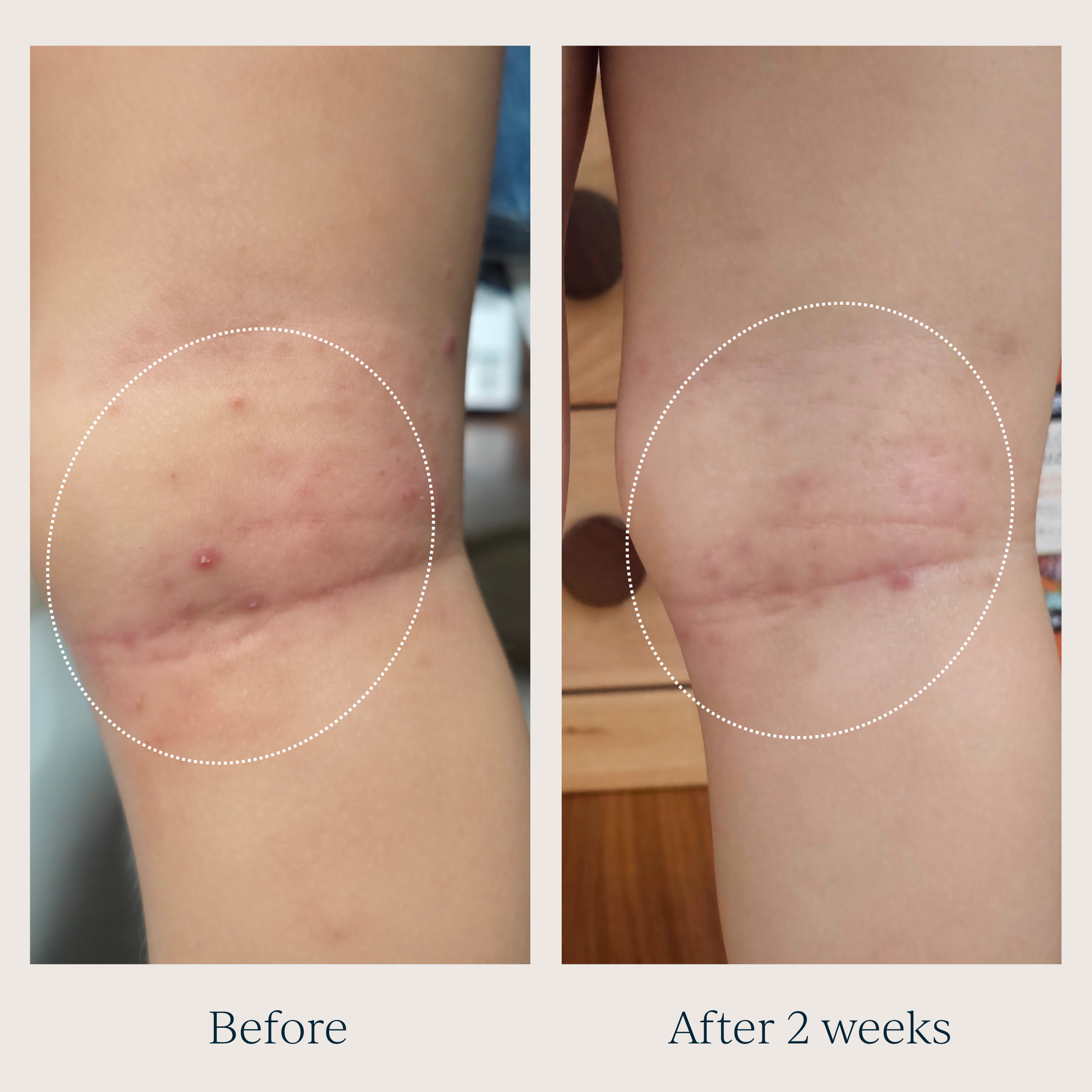 TOOFRUIT Magi'soin | My Multi-Purpose Balm