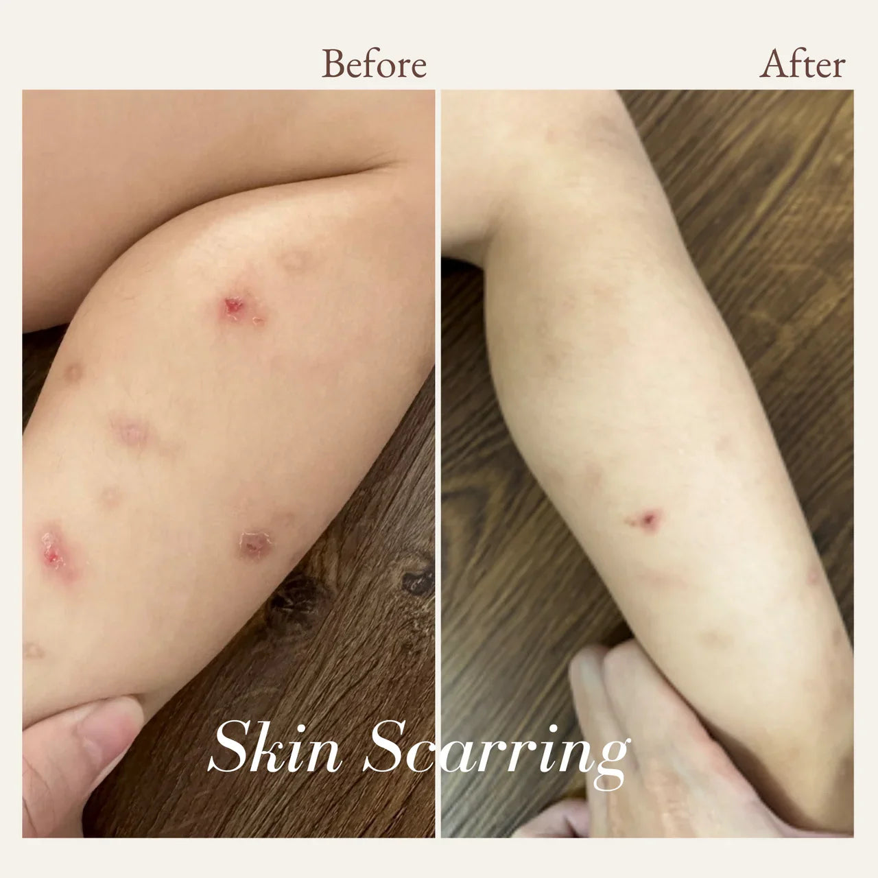 before and after pictures