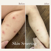 before and after pictures