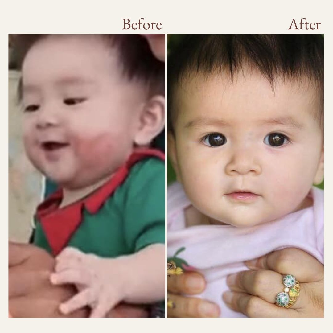 before and after photos from using vivaiodays olive oil rescue balm gel