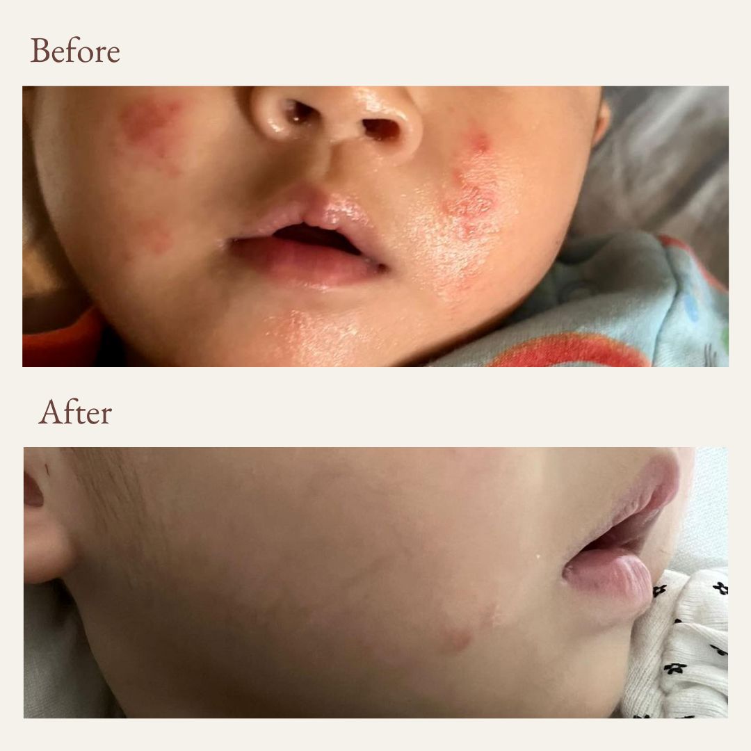 before and after photos from using vivaiodays olive oil rescue balm gel