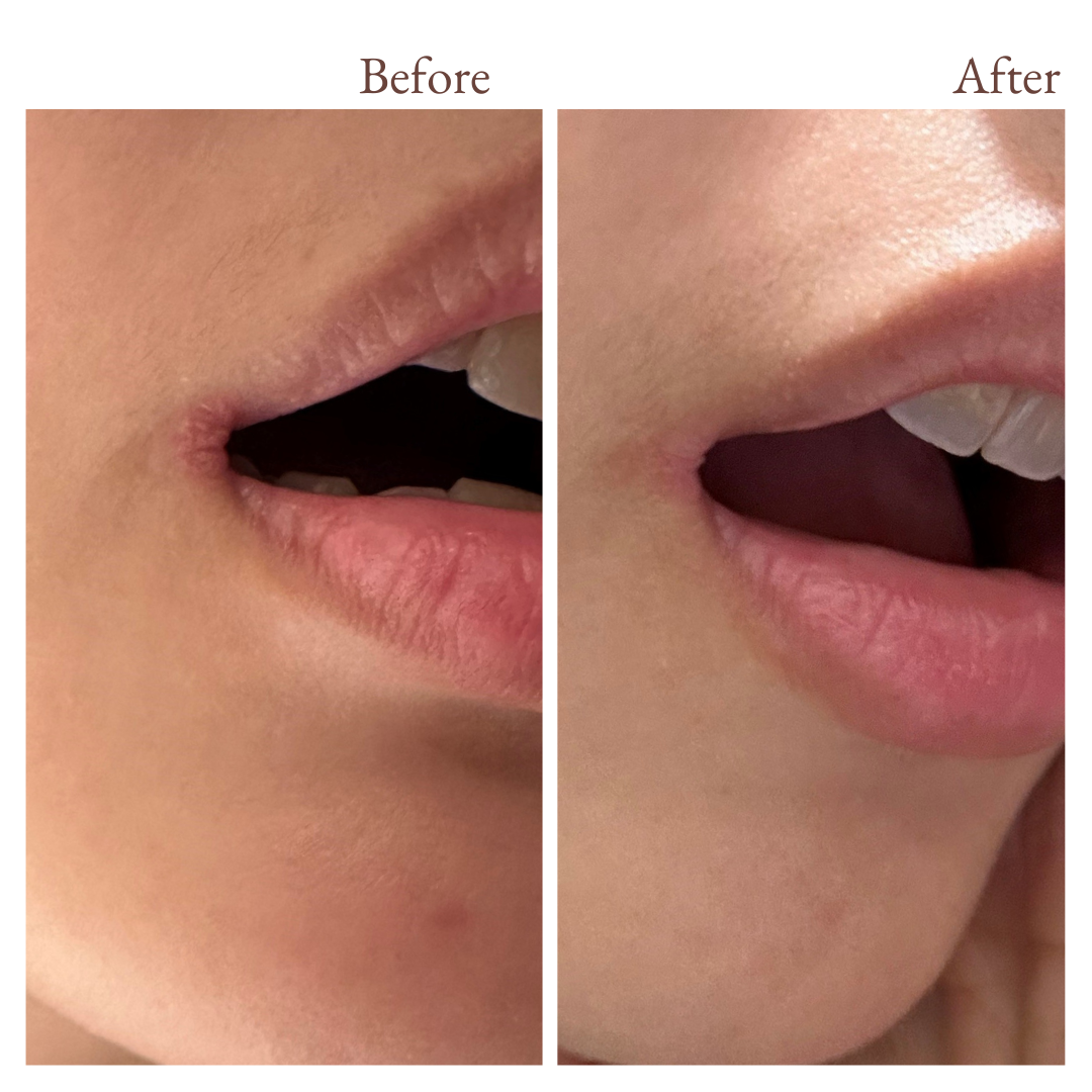 before and after photos from using vivaiodays olive oil rescue balm gel