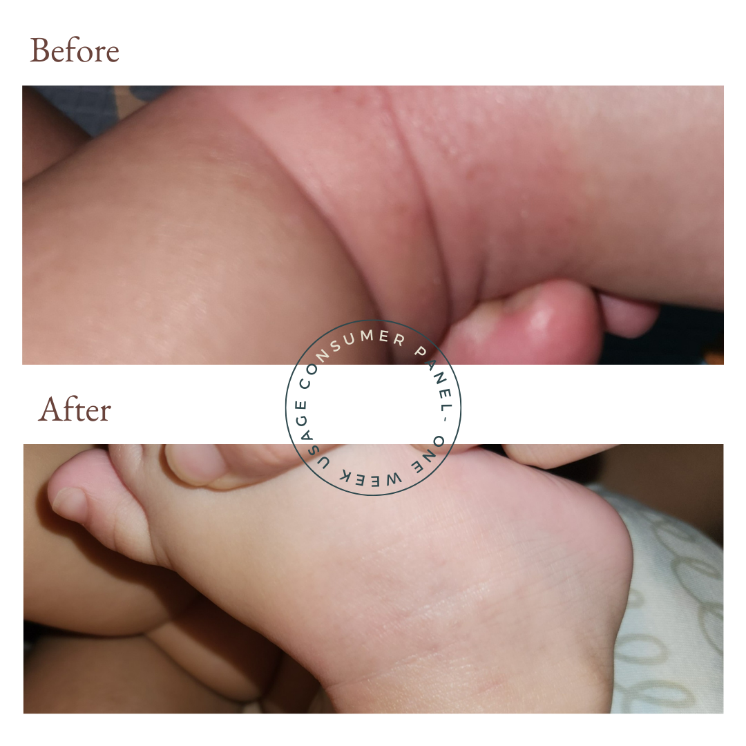 before and after photos from using vivaiodays olive oil rescue balm gel