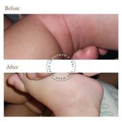before and after photos from using vivaiodays olive oil rescue balm gel