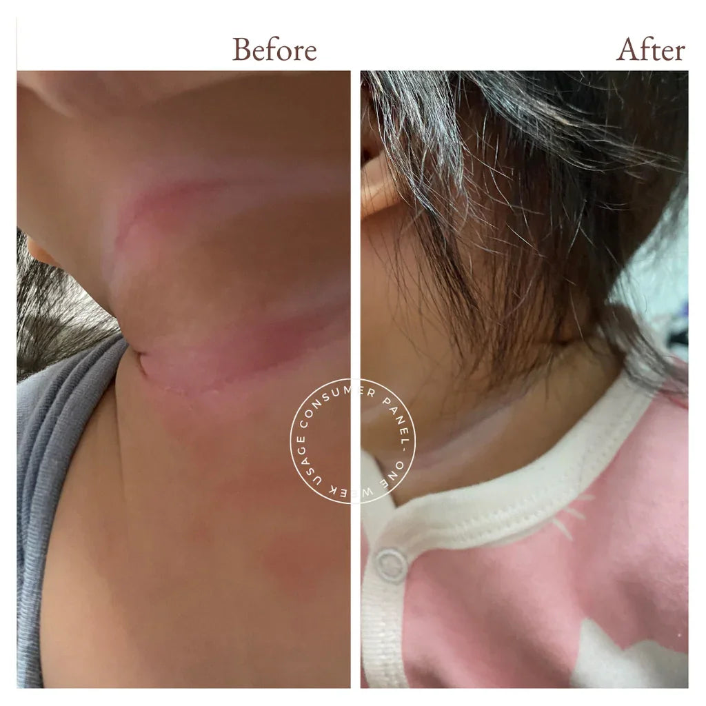 before and after photos