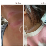 before and after photos