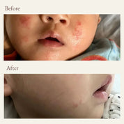 before and after photos