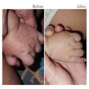 before and after photos